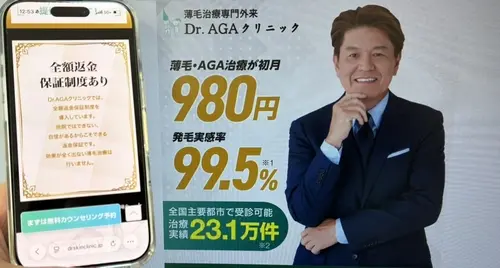 Dr.AGAクリニックのAGA治療