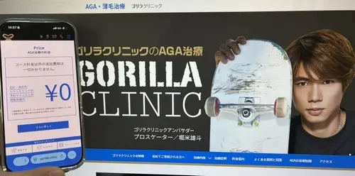 ゴリラクリニックのAGA治療