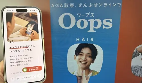 OopsHAIR（ウープスヘア）のAGA治療