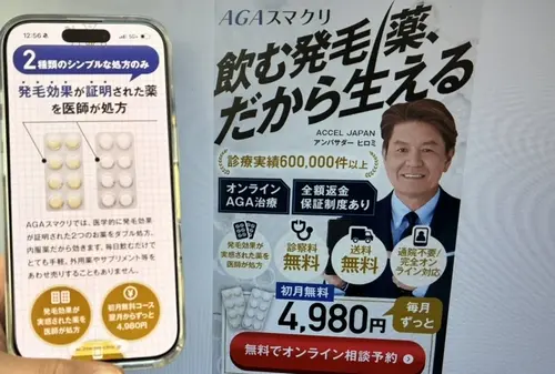 AGAスマクリのAGA治療