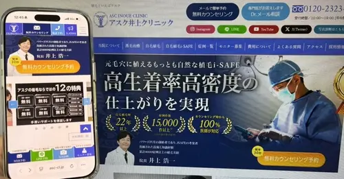 アスク井上クリニックの自毛植毛
