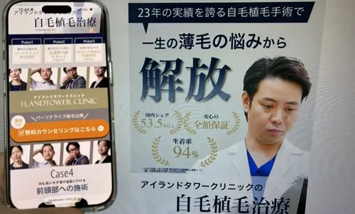 アイランドタワークリニックの自毛植毛