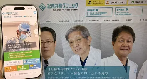 紀尾井町クリニックの自毛植毛