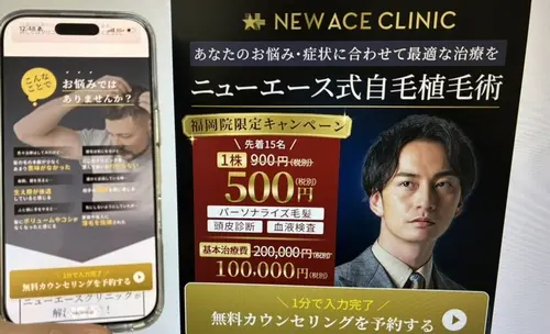 ニューエースクリニックの自毛植毛