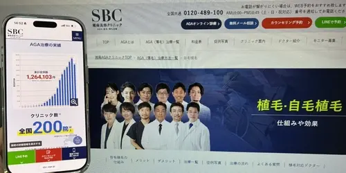 湘南AGAクリニックの自毛植毛