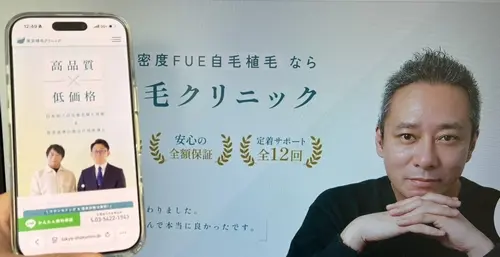 東京植毛クリニックの自毛植毛