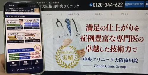 大阪梅田中央クリニックの包茎治療