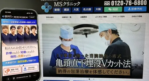 MSクリニックの包茎治療